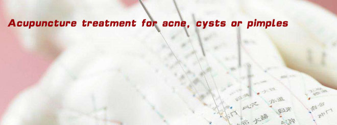 Acupuncture treatment for acne, cysts or pimples
