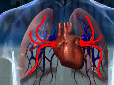 TCM Treatment for chronic pulmonary heart disease