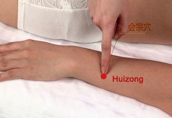 huizong (te7)