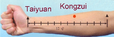 actupuncture single point kongzui