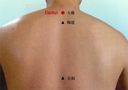 acupuncture single point dazhui