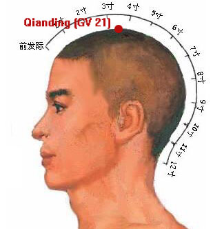 qianding (gv 21)