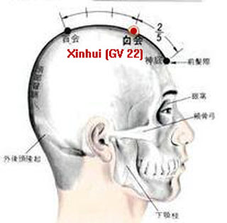 xinhui (gv 22)