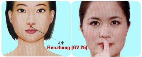 renzhong (gv 26)
