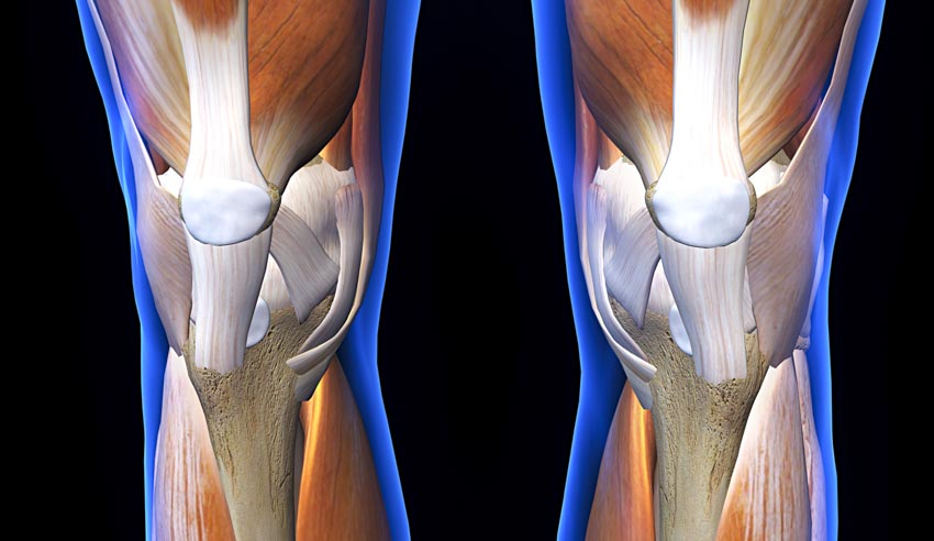 acupuncture stimulates cartilage repair due to knee osteoarthritis