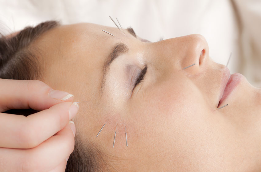 acupuncture effective for the treatment of facial paralysis