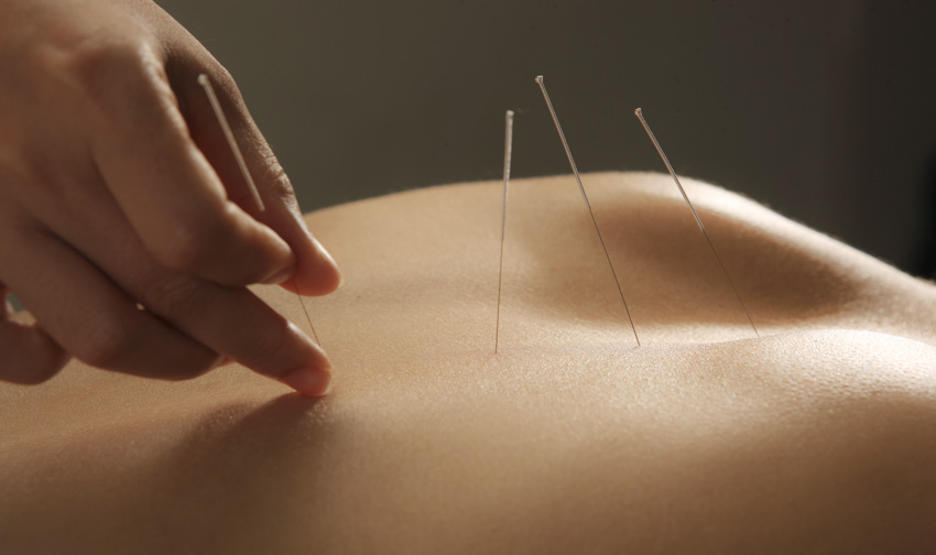 researchers find acupuncture effective for relieving allergic asthma