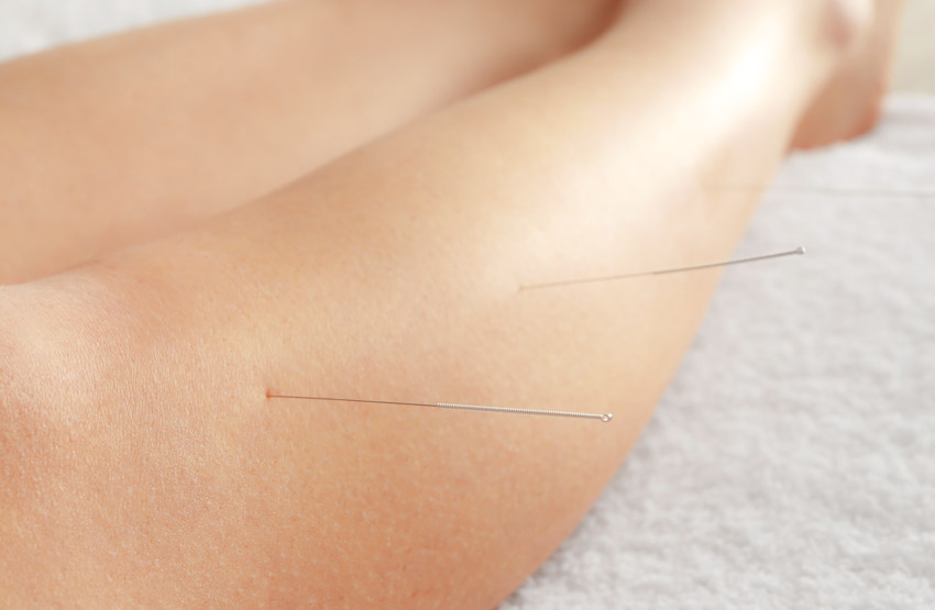 acupuncture has a 90 total effective rate for patients with ibs