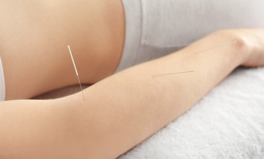acupuncture is a proven therapeutic method for tennis elbow
