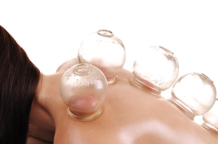 cupping as part of physical training regimen in olympic games