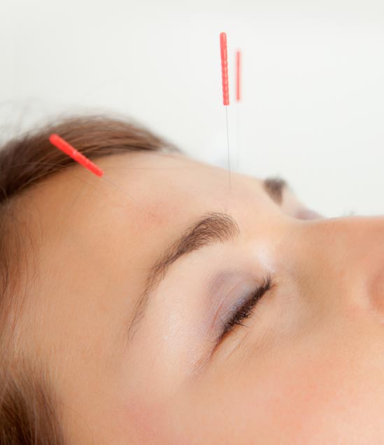 acupuncture contributed to the recovery of the visual function