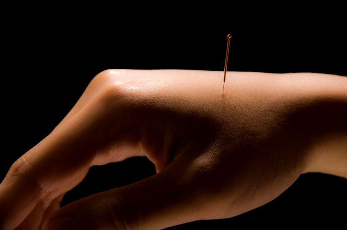 acupuncture indicated for patients receiving gynecologic laparoscopy