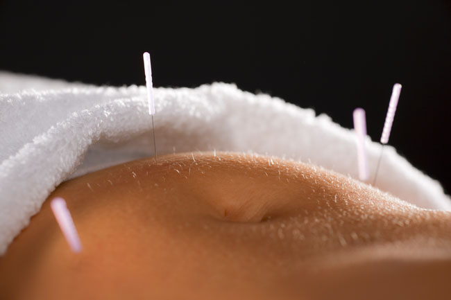 acupuncture and herbs alleviate perimenopausal symptoms