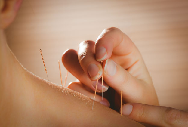 acupuncture and moxibustion alleviate neck pain