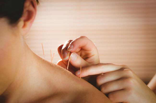 acupuncture relieves pain caused by cervical spondylosis