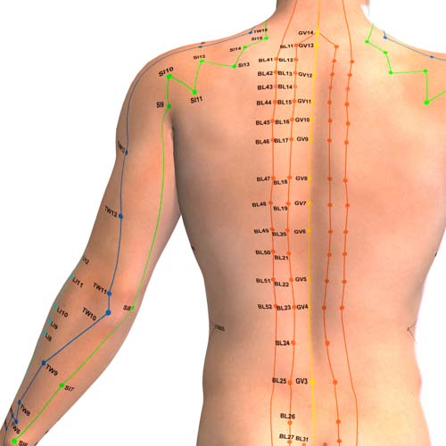 acupuncture relieve lower back pain due to disc herniations