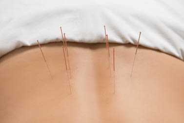 primary acupuncture points used  to treat sciatic pain
