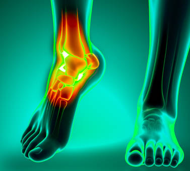 acupuncture point relieves pain and swelling due to ankle sprains