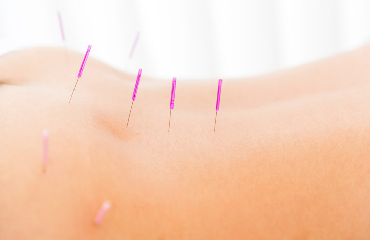 acupuncture reverses lower back pain disorders
