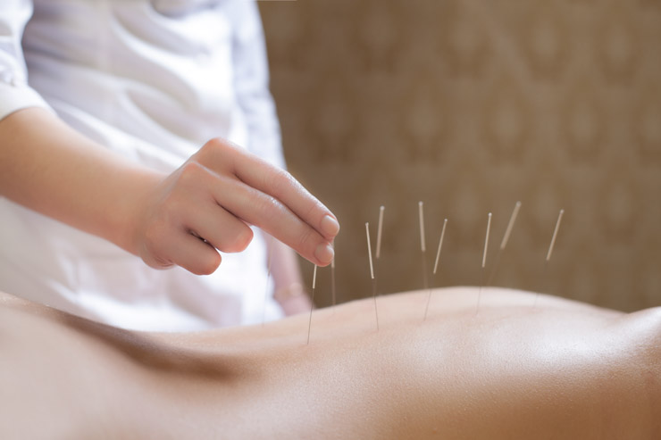 acupuncture effective for normalizing hormone levels