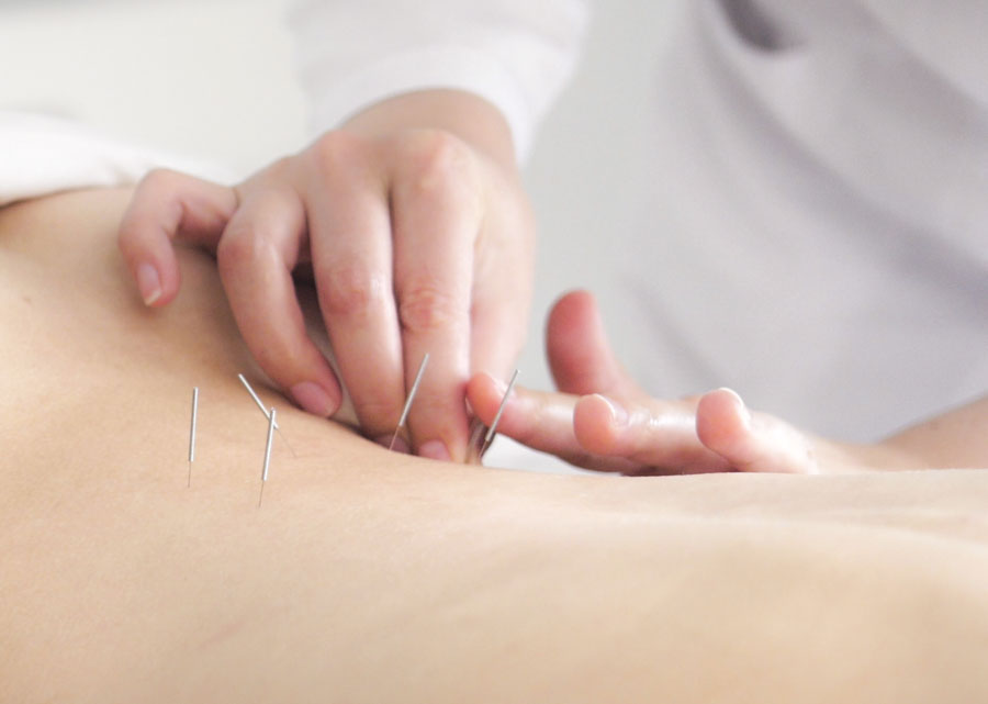 acupuncture used to beats drugs for urinary incontinence
