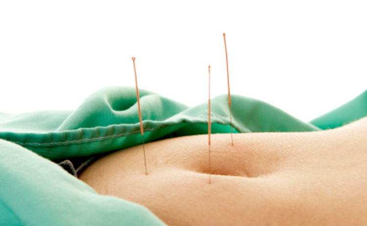 acupuncture relieves menstrual pain due to endometriosis