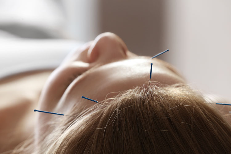 acupuncture outperforms drug therapy for the treatment of insomnia