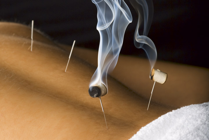 the efficacy of acupuncture techniques for lumbar disc herniation