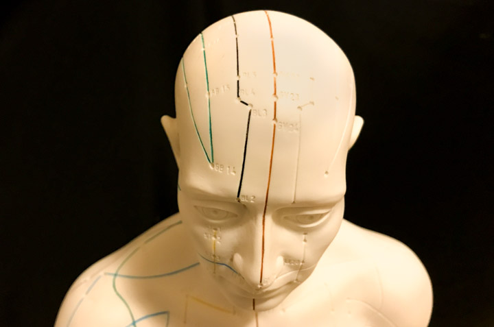 effects of acupuncture on patients with post stroke depression