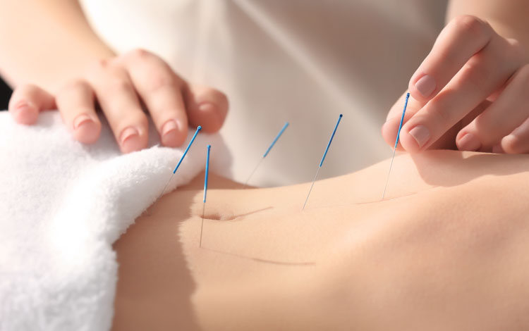 acupuncture prevents chemotherapy nausea and vomiting